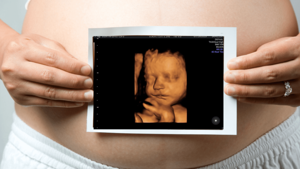 3D ultrasound in Mississauga